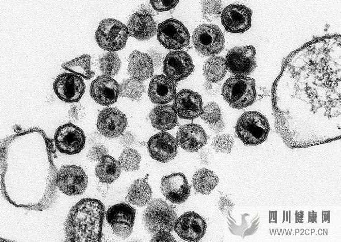 艾滋病毒和艾滋病有什么区别？