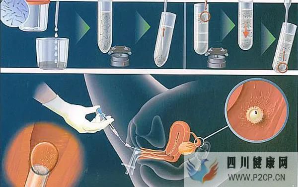试管真的可以解决怀孕困难吗??试管五点误区快看~(图1) 试管真的可以解决怀孕困难吗??试管五点误区快看~(图1)