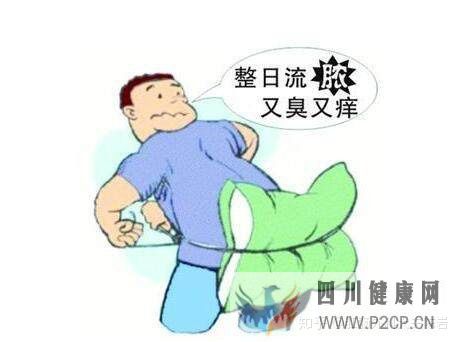 肛肠小知识教你判断这4种肛肠疾病!(图6) 肛肠小知识教你判断这4种肛肠疾病!(图6)