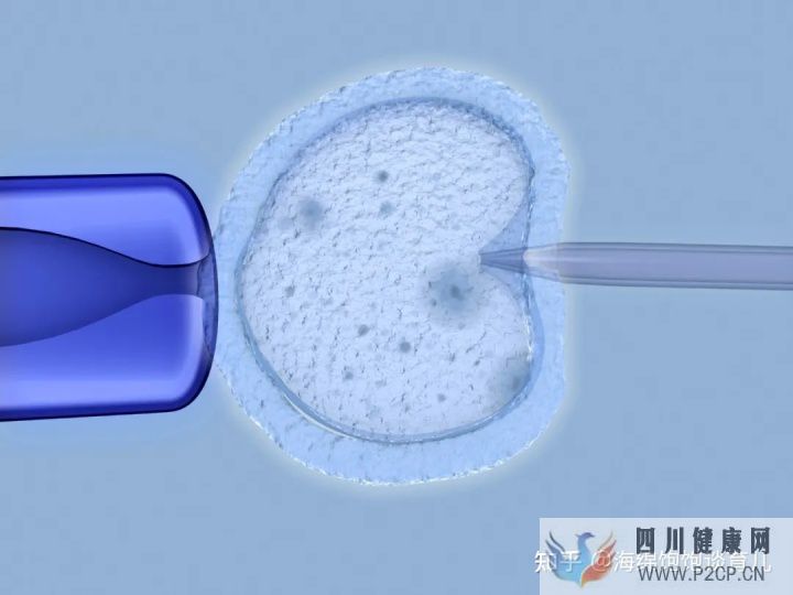 试管婴儿1代、2代、3代、4代哪个最好真实操作过...(第二代试管婴儿成功率有多少)(图11) 试管婴儿1代、2代、3代、4代哪个最好真实操作过...(第二代试管婴儿成功率有多少)(图11)