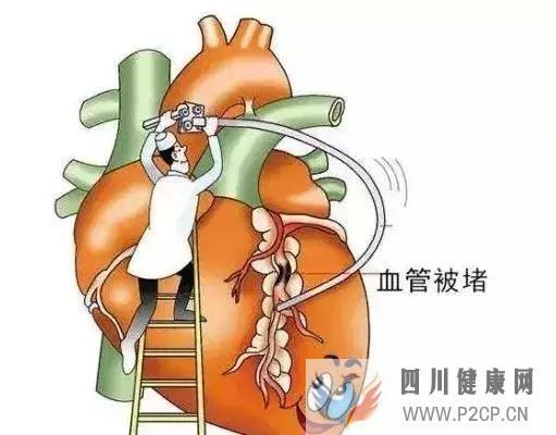 健身的十大好处,你全都知道吗(图11) 健身的十大好处,你全都知道吗(图11)
