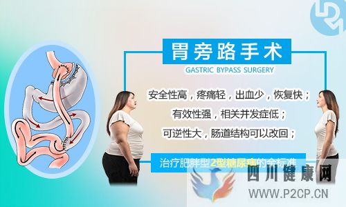 咨询:胃旁路手术能治好糖尿病吗?(图1) 咨询:胃旁路手术能治好糖尿病吗?(图1)