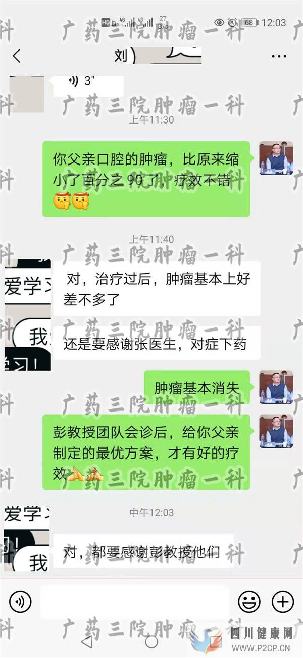 口腔肿块要警惕口腔癌广东口腔肿瘤医院