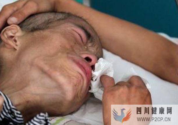 糖尿病症状早知道,7个征兆看出你是否有糖尿病,你都知道吗?(图1) 糖尿病症状早知道,7个征兆看出你是否有糖尿病,你都知道吗?(图1)