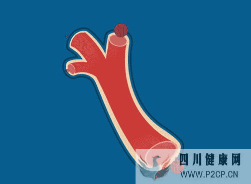 冬季做好这些事，不给心血管“添堵”，专家解读心血管的早期预防