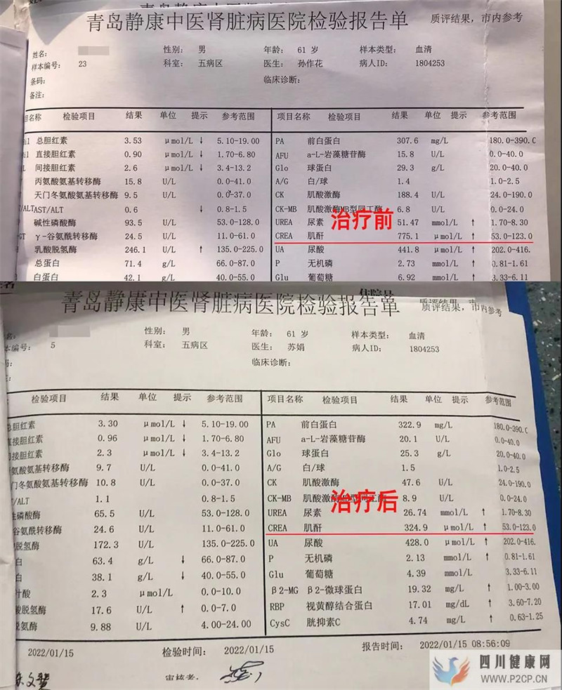 糖尿病肾病患者:为什么我要比其它肾病透析早?(图1) 糖尿病肾病患者:为什么我要比其它肾病透析早?(图1)