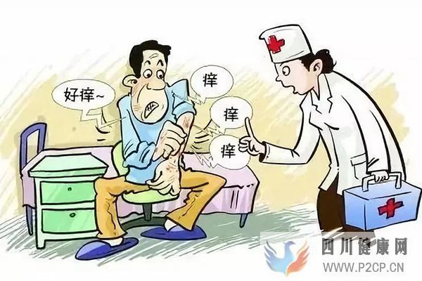 银屑病是怎么引起的?(图1) 银屑病是怎么引起的?(图1)