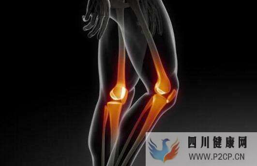 膝关节骨性关节炎的症状有哪些怎么治疗比较好健康百科(图1) 膝关节骨性关节炎的症状有哪些怎么治疗比较好健康百科(图1)
