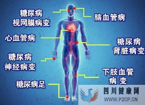 糖尿病患者出现这些的症状时应警惕糖尿病肾病(图1) 糖尿病患者出现这些的症状时应警惕糖尿病肾病(图1)