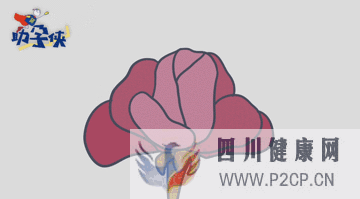 输卵管不通怎么办!(图10) 输卵管不通怎么办!(图10)