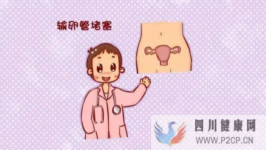 输卵管堵塞也是分类型的(图1) 输卵管堵塞也是分类型的(图1)