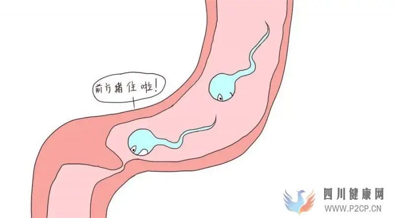 输卵管堵塞会有哪些症状(图1) 输卵管堵塞会有哪些症状(图1)