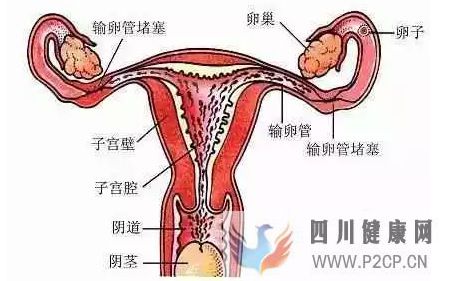 不孕不育输卵管不孕,女性不孕的最大危害之一!(图2) 不孕不育输卵管不孕,女性不孕的最大危害之一!(图2)