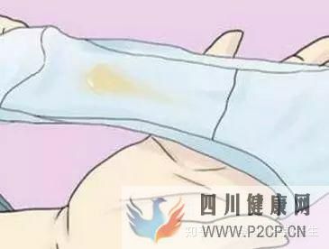 不孕症有哪些常见症状(图8) 不孕症有哪些常见症状(图8)