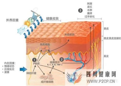 皮肤过敏,从原因到解决方案(图13) 皮肤过敏,从原因到解决方案(图13)