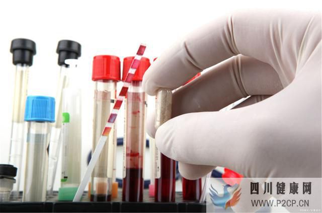 男子糖尿病肾病肌酐高过千,中医降肌酐停透析康复,中医治疗方法(图1) 男子糖尿病肾病肌酐高过千,中医降肌酐停透析康复,中医治疗方法(图1)