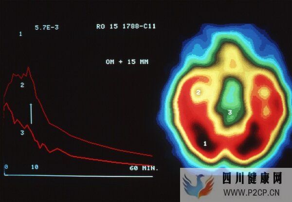 呼吸道病毒感染潮蔓延背后,CT正在被滥用?(图5) 呼吸道病毒感染潮蔓延背后,CT正在被滥用?(图5)